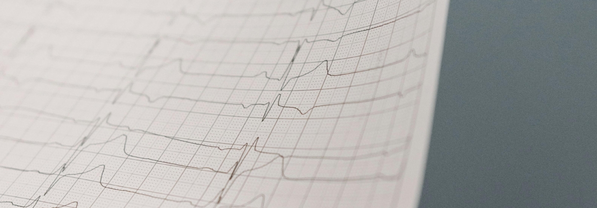 EKG technician job description