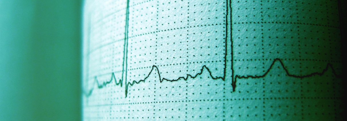 ekg technician school