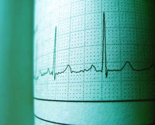 ekg technician school