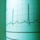 ekg technician school
